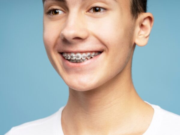 A young boy is smiling big while wearing braces
