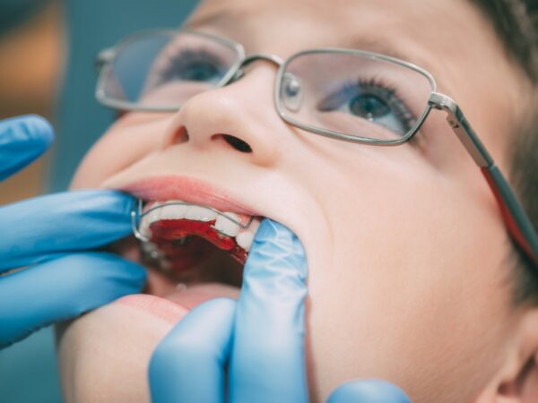 A young boy wearing glasses is having his retainer checked by the orthodontist