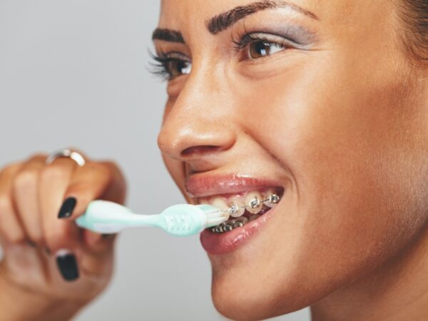 Woman wearing braces is brushing her teeth.