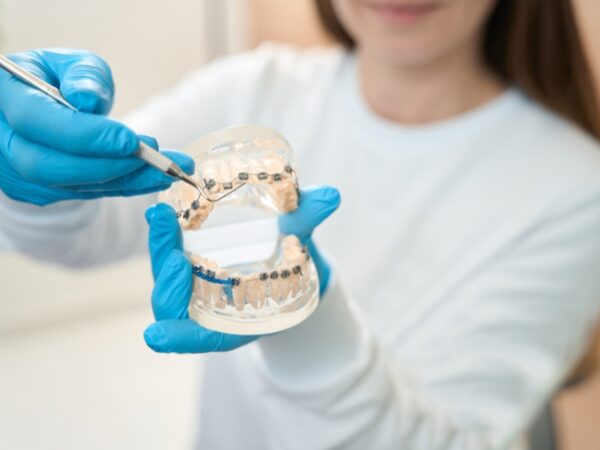 Orthodontist is holding a model of a mouth with braces on it.